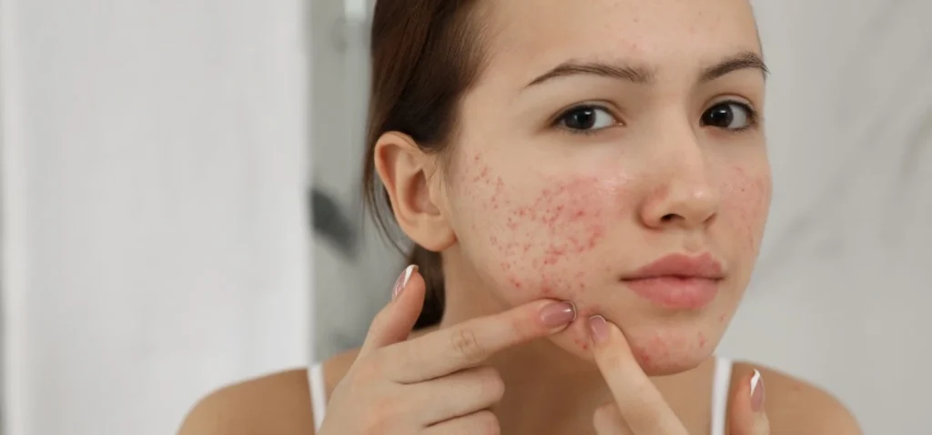 Kosmetyki profesjonalne | Egzosomy | NAQUA
